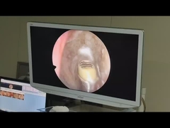 Dispositivo quirúrgico Generador de plasma de alta frecuencia de radio frecuencia